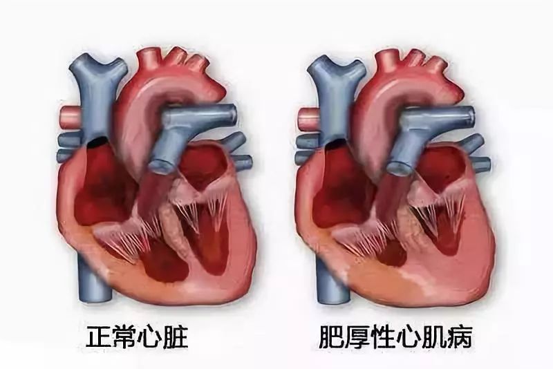 心脏运动_运动员心脏概念_运动员心脏